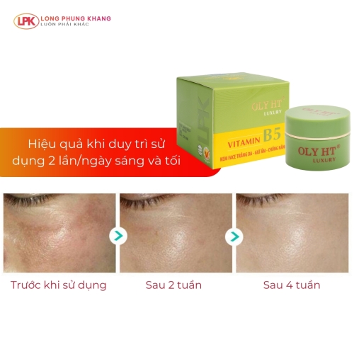 OLY HT Luxury Vitamin B5 Kem Trắng Da Giữ Ẩm Chống Nắng OLY HT Luxury Vitamin B5 Kem Trắng Da Giữ Ẩm Chống Nắng